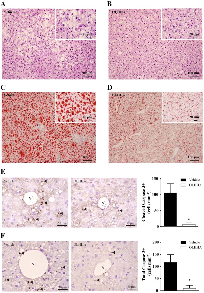 Effects of OLHHA on the fatty liver in obese Zucker rats. Representative images after the histological and immunohistochemical analysis of liver sections. The histological analysis of liver sections was performed using Hematoxylin and Eosin (A,B) and Oil Red O stain (C,D) to examine the effects of OLHHA on the size, number and appearance of hepatocytes and fat vacuoles in the obese rats. The immunohistochemical analysis of liver sections was performed to detect cleaved caspase-3 (E) and total caspase-3 (F) to examine the apoptotic state after a 15-day exposure to vehicle or OLHHA (5 mg kg−1, daily, i.p.). The scales are indicated in each image. The arrows indicate positive cells (brown stain). The bars indicate the means±s.e.m. (n=3 determinations in duplicate per group). The data were analyzed using Student's t-test. *P<0.05 denotes significant differences compared with the vehicle-treated rats.