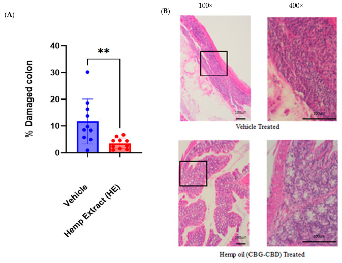 Colonic damage was assessed using H&E staining. (A) Colon damage (ulceration) was significantly lower for HE treated mice than control mice as measured by percentage of damaged epithelium. (B) Representative images (100×) of vehicle-treated and hemp oil-treated mouse colon highlighting damage to the colon; boxed region is shown at higher magnification (400×). (n = 10 mice/group, ** p < 0.01).