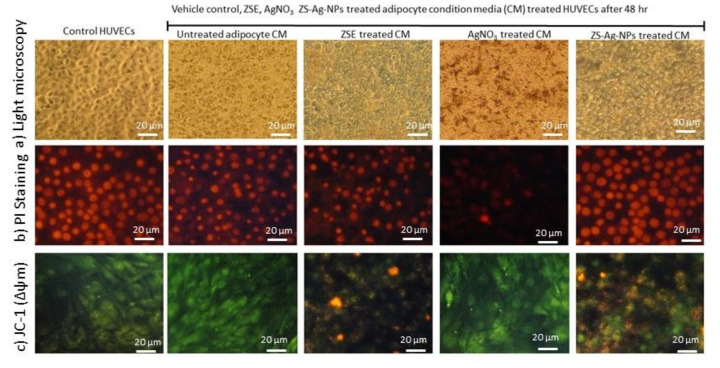Analysis of the vehicle control, ZSE, AgNO3, and ZS-Ag-NPs treated adipocytes condition media supplemented HUVECs on cell morphology by light microscopy (a), PI Staining for nuclear damage (b) and JC-1 staining for mitochondrial membrane potential (c) after 48 h.