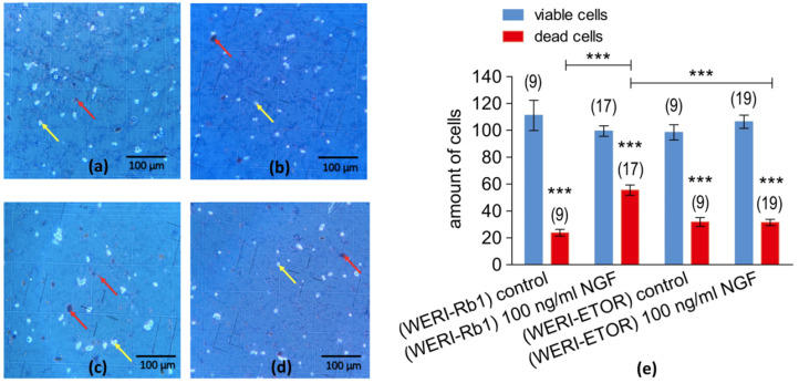 Microscopic images of trypan blue staining of RB cells. The microscopic images (scale bar 100 µm) show dead cells (dark dots), which were marked with red arrows and the living cells (light dots) with yellow arrows. (a) WERI-RB1 cells after 5 days of cell cultivation without NGF application (control group). (b) WERI-ETOR after 5 days of cell cultivation without NGF application (control group). (c) Same group as shown in (a) but after 5 days of incubation with 100 ng/mL NGF. (d) Same group as shown in (b) but after 5 days of incubation with 100 ng/mL NGF. (e) Comparison of NGF-induced lethality in in WERI-Rb1 and in WERI-ETOR cells. The numbers in brackets indicate the number of measurements. The number of viable (in blue) and dead cells (in red) of etoposide-sensitive (WERI-Rb1) and etoposide-resistant (WERI-ETOP) is shown in the Y-axis. RB cell cultures with and without NGF treatment. Cells are incubated with 100 ng/mL NGF, and cell number is determined after 5 days. Untreated cells (without NGF) served as controls. Declines in cell viability are larger in NGF-treated WERI-Rb1 cells than in WERI-ETOR cells. NGF enhances etoposide-induced cytotoxicity more in WERI-Rb1 cells than in WERI-ETOR cells. *** p < 0.001; were considered statistical significance between groups.