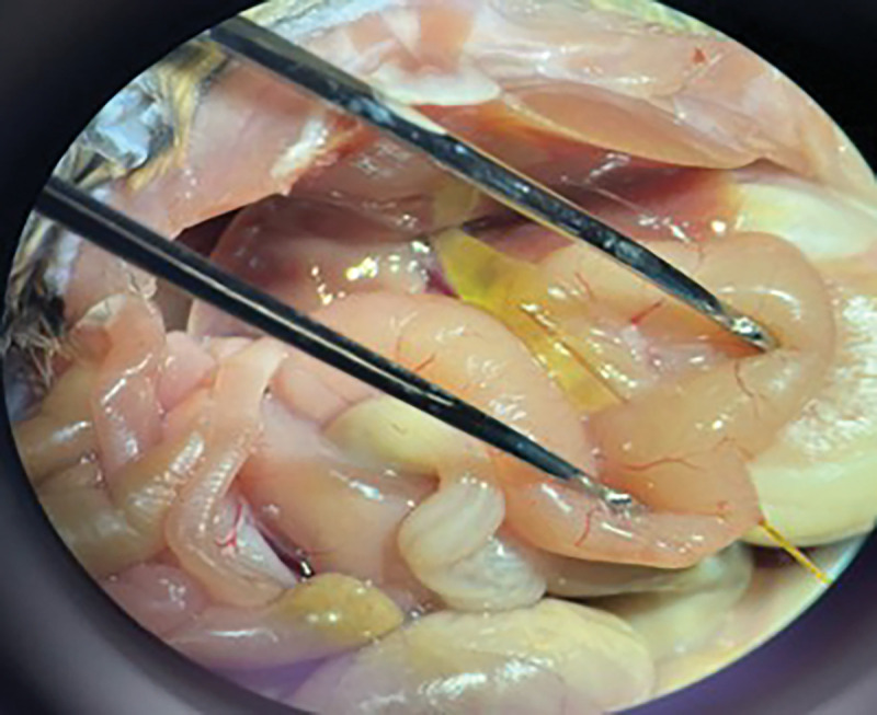 Blunt tip catheter inserted through the ampulla in a transduodenal fashion at necropsy at 12 weeks of age in an experimental mouse easily passes into the cyst lumen (Catheter tip within the cyst lumen denoted by green arrowhead)