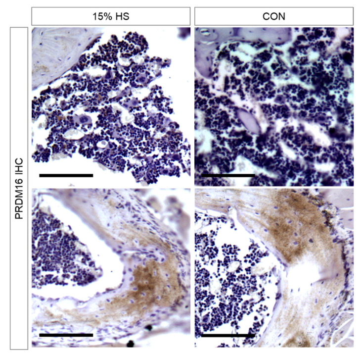 Humerus immunohistochemical staining of PRDM16-positive cells in representative mice from the 15% HS and control groups. Top row: Bone marrow sections showing the density of PRDM16-positive cells (brown color), an indication of differentiated adipocytes. Bottom row: Humerus metaphysis sections displaying comparable staining between the treatment groups. Scale bar indicates 100 μm.