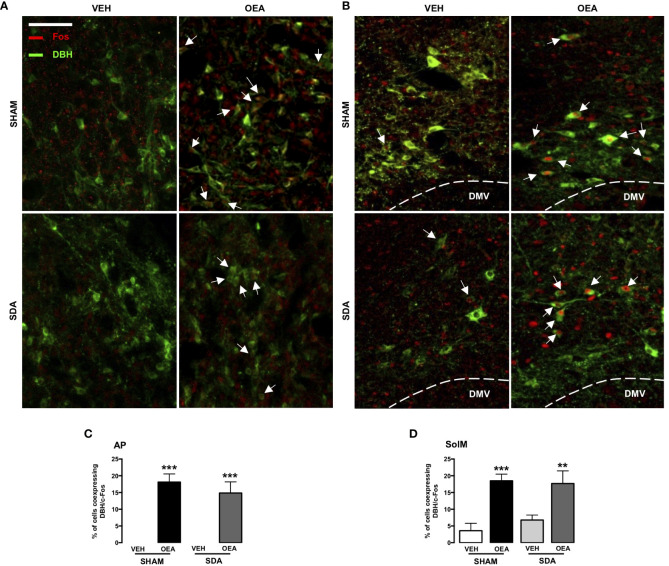 c-Fos and DBH double immunostaining within the AP and SolM of both SHAM and SDA rats. Representative fluorescent photomicrographs (x20 magnification, scale bar = 100 mm) showing c-Fos/dopamine beta-hydroxylase (DBH) double-immunostaining (red/green), of the area postrema (AP; A) and the medial part of nucleus of the solitary tract (SolM; B). White arrows indicate neurons, within AP and SolM, that co-express c-Fos and DBH signals (% of Fos-positive neurons: percentage of cells co-expressing c-Fos and DBH), measured in AP sections (C) and SolM sections (D) of SHAM and SDA rats after VEH or OEA treatment. Data are expressed as means ± SEM. ***p < 0.001 and **p < 0.01 vs. VEH in the same surgery group (Tukey’s test).