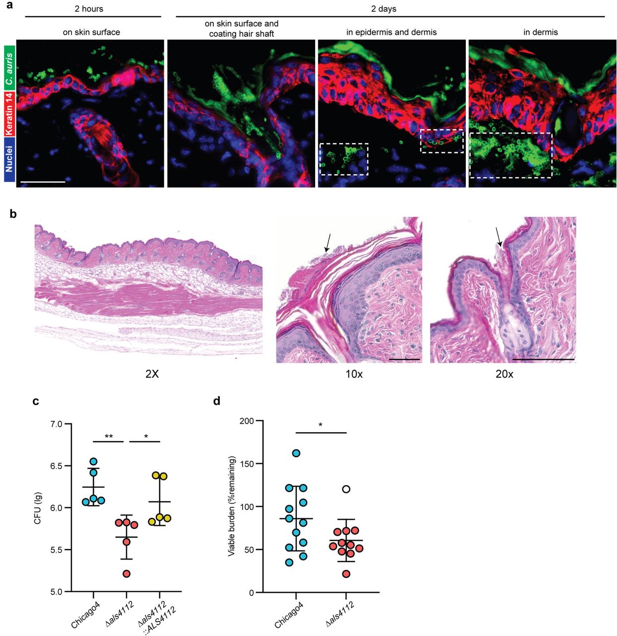 Als4112 facilitates C. auris colonization of host skin.(A) Immunofluorescence staining was performed to visualize the localization of C. auris cells (green) in the skin 2 hours or 2 days post infection. The keratin 14 signal (red) marked the epidermis and Hoechst was used to stain the nuclei. Scale bar, 25 μm. (B) H&E staining of murine skin infected with C. auris. Arrows point to fungal cells on the skin surface and coating the hair shaft. Scale bar, 100 μm (C) C. auris bioburden after 2 days of incubation on murine skin in vivo. Data are presented as CFU/g of tissue, normalized to the delivered inocula. n = 5 mice. (D) C. auris cells were applied to ex vivo human skin samples and incubated for 24 hours before washing. Recovered CFU after wash were normalized to the average total burden for each strain in each experiment (% remaining). Values represent the mean ± s. d., calculated from two biological replicates with 5-6 technical replicates each, depending on skin availability. A single outlier (open circle) was identified and removed using Grubb’s test. Excluding the outlier point, P = 0.02, including the outlier point, P = 0.07. Statistical differences were determined using one-way ANOVA with Dunnett’s multiple comparisons test (C) or unpaired t-test (D); *P ≤ 0.05; **P ≤ 0.01.