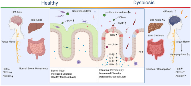 Healthy and Dysbiosis States of the Gut-Brain Axis. Dysregulation of the gut-brain axis results in alterations to available microbes, metabolites, and inflammatory signals. SCFA, bile acids, and neurotransmitters are decreased or dysregulated through community shifts. A decrease in SCFA impairs tight junctions and allows for intestinal permeability, which is linked to activation of a wide range of proinflammatory signals and pathways. Bile acid dysregulation contributes to liver cirrhosis and alterations of the microbial community through the antimicrobial properties of bile acids. Inflammation in the gut is increased through the hypothalamic pituitary axis (HPA) and has feedback to the central nervous system, increasing pain, stress, and anxiety