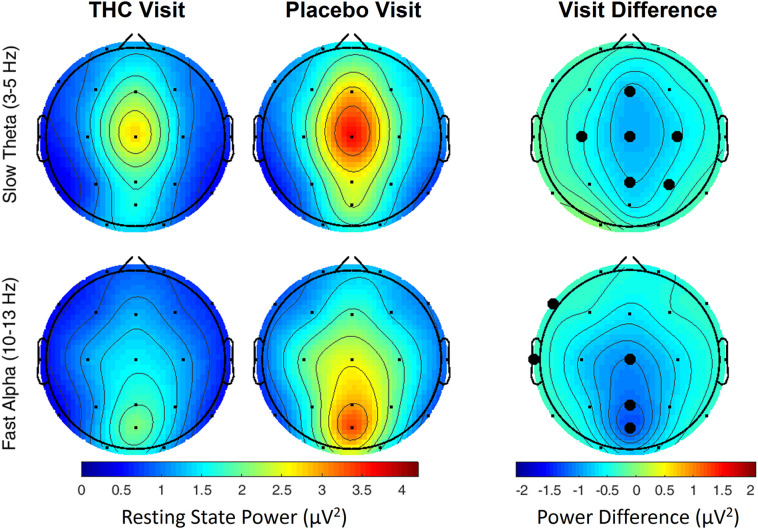 Resting state eyes open by visit. During THC visit, spectral power fell relative to placebo visit at slow Theta and fast Alpha frequency bands. Topographic maps show widespread decreases in midline Theta (top row) and fast Alpha (bottom row) from THC visit to placebo visit. Filled black circles mark channels that were significantly different between the visits prior to FDR correction for multiple comparisons.