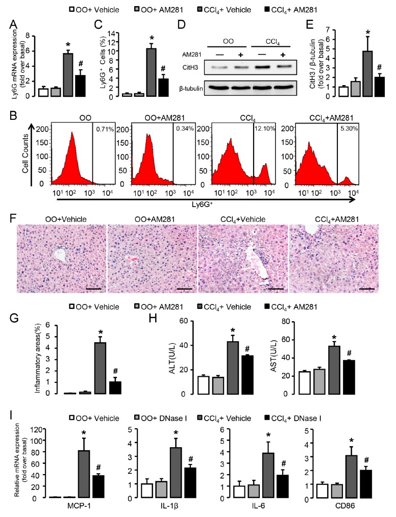 Blockade of CB1 significantly attenuates neutrophil infiltration and liver inflammation in CCl4-treated mice. (A) Ly6G mRNA expression in CCl4- or olive oil (OO)-treated liver with or without the administration of AM281. (B,C) Representative FACS plots and quantification for neutrophils in liver. (D,E) CitH3 protein levels in liver. (F) Representative H&E staining images of liver sections. Scale bars, 100 μm. (G) Quantitative analysis of liver inflammation areas. (H) Alanine aminotransferase (ALT) and aspartate aminotransferase (AST) levels were detected by chemistry analyzer. (I) mRNA expression of MCP-1, IL-1β, IL-6, and CD86 in CCl4- or OO-treated liver with or without the administration of DNase I. Data are presented as the mean ± SEM. N = 6 per group. * p < 0.05 vs. OO. # p < 0.05 vs. CCl4-treated alone.