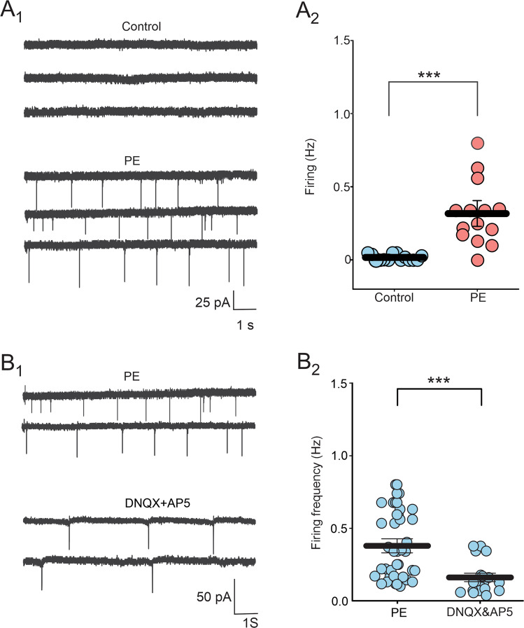 Prenatal ethanol exposure increases the spontaneous firing activity of DRn 5-HT neurons by increasing glutamatergic synaptic transmission.A PE increases the firing activity of DRn 5-HT neurons. A1 Cell-attached recordings of DRn 5-HT neurons from control (upper panel) and PE rats (lower panel). A2 Summary of the average firing frequency of DRn 5-HT neurons recorded from control (, n = 14, N = 5 from 3 litters) and PE rats (, n = 14, N = 5 from 3 litters, Mann-Whitney test: p < 0.001). B Blockade of ionotropic glutamate receptors significantly reverses the PE-induced increase in spontaneous firing activity of DRn 5-HT neurons. B1 Recordings of spontaneous firing activity of DRn 5-HT neurons from PE rats in the absence (upper traces) and presence (lower traces) of AMPA and NMDA receptor antagonists, DNQX (20 µM) and AP5 (20 µM), respectively. B2 Summary graph of the spontaneous firing frequency of DRn 5-HT neurons recorded in PE rats in the absence (n = 38, N = 10 from 5 litters) and presence of DNQX and AP5 (n = 20, N = 7 from 3 litters, Mann-Whitney test: p < 0.01). n = number of cells, N = number of rats.