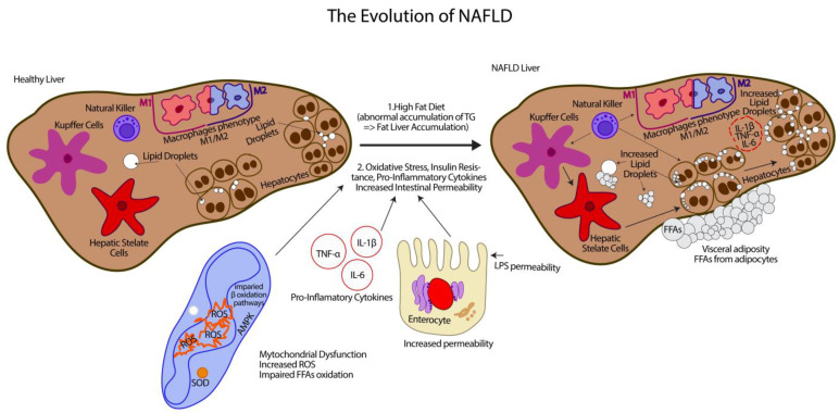 Liver damage in NAFLD.