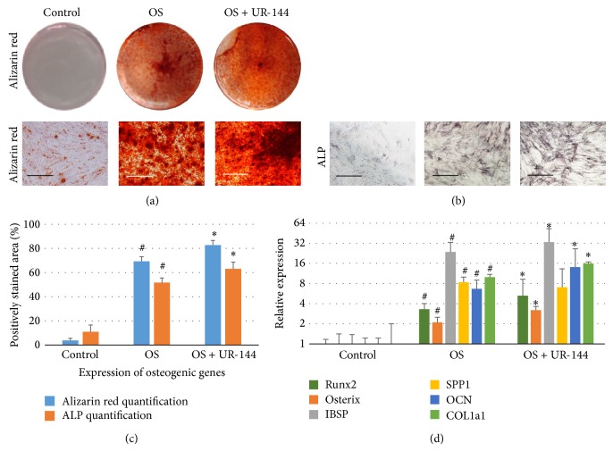 Osteogenic differentiation of BM-MSC was enhanced by agonist of cannabinoid receptor 2. (a) Alizarin red staining of BM-MSC after 3-week culture. Bar = 100 μm. (b) Alkaline phosphatase staining (ALP) after 2-week culture. Bar = 100 μm. (c) Quantification of positively stained area for alizarin red staining and ALP staining reveals that OS + UR-144 group has more mineralization and more ALP activity than OS group. (d) Real-time PCR was performed to analyze osteogenic genes in BM-MSC after 3-week culture (N = 4). GAPDH was amplified for normalization. OS = osteogenic medium. # represents significant difference when comparing OS group with control group. ∗ represents significant difference when comparing OS + UR-144 with OS group.