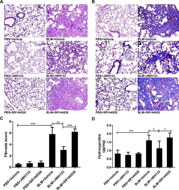 CB2R agonist JWH133 prevents bleomycin-induced lung damage and fibrosis in mice(A and B) Representative microphotographs (200 ×) of lung tissue slices stained by HE and Masson. (C) Semi-quantitative fibrosis scoring was assessed according to the Ashcroft scale. Slides were scored by a single investigator blindly. Bar, 100 μm; Graphs show mean ± SD of at least six mice for each group. (D) The hydroxyproline (Hyp) content of the pulmonary tissues was measured and presented as micrograms of Hyp per milligram of wet weight (μg/mg). *P < 0.05, **P < 0.01, ***P < 0.001.