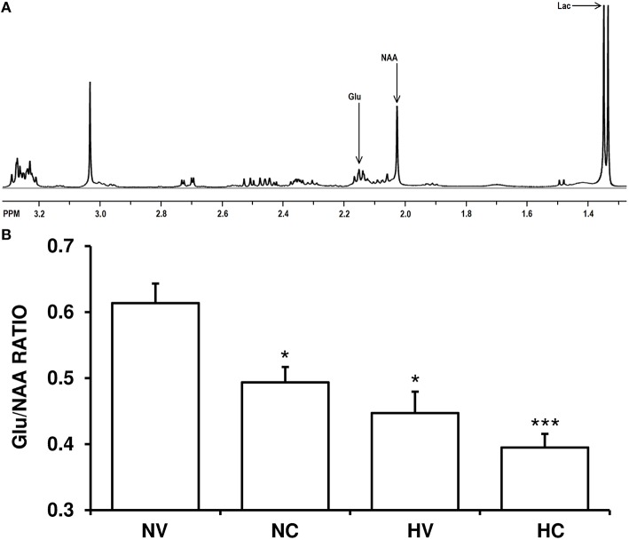 Effect of the treatments on the characteristics of excitotoxicity. (A) A representative brain spectra from a hypoxic-ischemic animal managed with normothermia (NV group). Arrows show the metabolite peaks of glutamate (Glu), N-acetylaspartate (NAA) and lactate (Lac). (B) Bars represent the results of Glu/NAA ratio (mean ± SEM), in brain samples from 1- to 2-day-old piglets after hypoxic-ischemic insult, treated with normothermia or hypothermia and administered with either vehicle or cannabidiol. (*) P < 0.05 vs. NV group by Kruskall-Wallis one-factorial analysis of variance; (***) P < 0.05 vs. all groups by Kruskall-Wallis one-factorial analysis of variance.