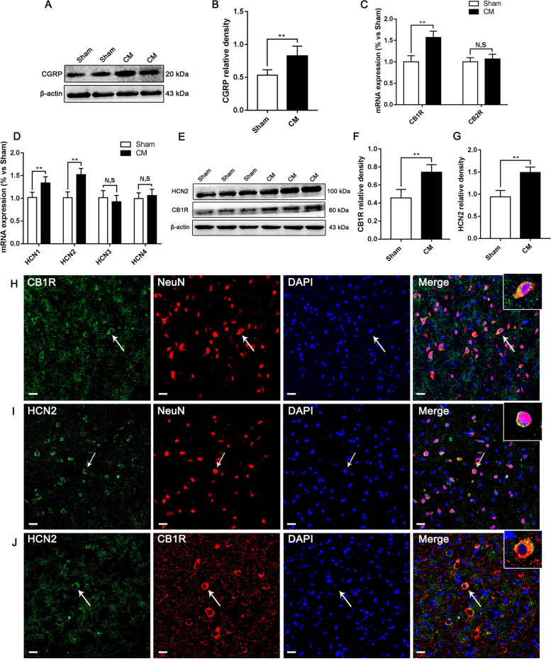 The change and distribution of cannabinoid receptors and HCN channels in the PAG of CM rats. A Representative western blots of CGRP. B The level of CGRP expression was substantially increased in the CM group compared to that in the Sham group. (n = 6/group, **p < 0.01). C The mRNA expression of CB1R in the CM group was markedly higher than that in the Sham group. The mRNA expression of CB2R was not markedly different between the CM and Sham groups; (n = 6/group, **p < 0.01, N, S, not significant). D The mRNA levels of HCN1 and HCN2 were substantially higher in the CM group than those in the Sham group. No change was found at the mRNA levels of HCN3 and HCN4 between the Sham and CM groups. (n = 6/group, **p < 0.01, N, S, not significant). E Representative western blots of CB1R and HCN2. F-G Compared with the Sham group, the protein levels of CB1R and HCN2 in the CM group were drastically increased. H Double immunofluorescence labeling of CB1R (green) and NeuN (red). In the PAG, almost all CB1R was expressed in neurons (as shown by the white arrow). (scale bar = 20 μm). I Double immunofluorescence labeling of HCN2 (green) and NeuN (red). HCN2 was found to be clearly expressed in neurons of the PAG (as shown by the white arrow). (scale bar = 20 μm). J Double immunofluorescence labeling of HCN2 (green) and CB1R (red) revealed that CB1R was coexpressed with HCN2 (as shown by the white arrow). (scale bar = 20 μm)