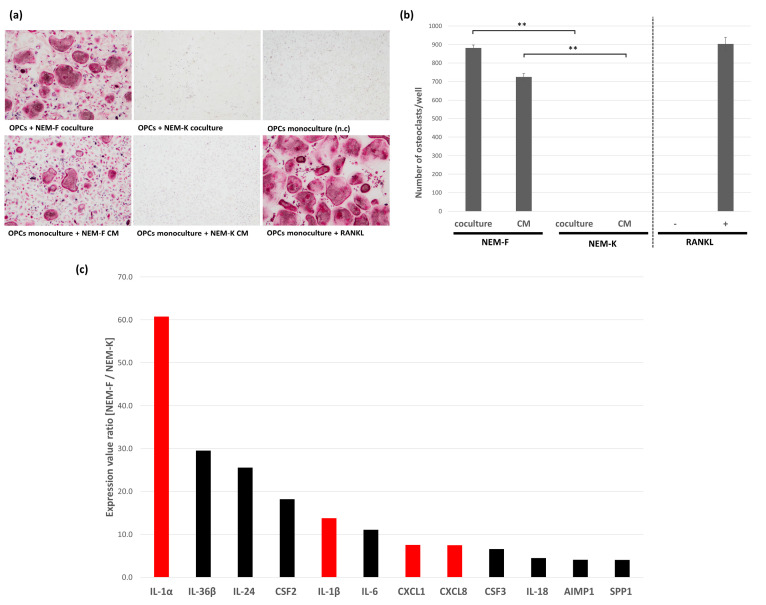 Osteoclastogenic properties of two subclones derived from the OSCC cell line, NEM. (a) Representative views of TRAP staining 5 days after the coculture of NEM-F or NEM-K cells with OPCs, and 5 days after the culture with culture supernatant of NEM-F or NEM-K cells. After 5 days of culturing OPCs in the growth medium supplemented with or without RANKL, the cells also functioned as positive and negative controls. (b) The number of osteoclasts induced by NEM-F relative to that induced by NEM-K, and the number of osteoclasts induced in cultures of OPCs supplemented with RANKL relative to that without supplementation of RANKL in the growth medium. ** p < 0.01 (one-way ANOVA with the Tukey–Kramer method). (c) Gene expression value ratio in NEM-F relative to that in NEM-K, analyzed with the gene expression microarray, sorted by the ratio as “>4-fold” and the GO Molecular Function Term as “cytokine activity”. Red bars represent selected inflammatory cytokines that have been reported to have an association with osteoclastogenesis. Preferential expression of the selected inflammatory cytokines was also detected in a gene expression microarray analysis used in our previous study (NCBI Gene Expression Omnibus, GE12341).