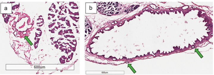 a Hematoxylin and eosin staining of control mouse bile duct harvested at 12-weeks of age (4x magnification); normal intramural peribiliary gland denoted by green arrow b Hematoxylin and eosin staining of experimental mouse extrahepatic bile duct harvested at 12-weeks of age (4x magnification); normal intramural peribiliary glands denoted by green arrows