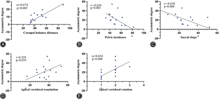 Graph showing the correlation between asymmetric degree in ES and CBD at the apex of the fractional curve (A), and that in MS and PI, SS, AVT, AVR at the apex of the fractional curve in Type C (B‐E). ES, erector spinae; CBD, coronal balance distance; MS, multifidus; PI, pelvic incidence; SS, sacral slope; AVT, apical vertebral translation; AVR, apical vertebral rotation.