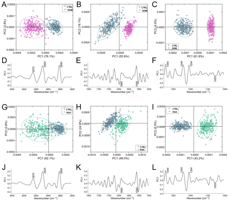 Multivariate analysis. PCA score plots and corresponding PC1 loadings calculated on CTRL, GDM, and SGA spectral populations in the 3050–2800 cm−1 (A,D and G,J), 1800–1480 cm−1 (B,E and H,K), and 1350–1000 cm−1 (C,F and I,L) intervals. For a better comprehension, PC1 loadings of the three selected intervals are displayed with different Y scales. CTRL: control group (blue), GDM: gestational diabetes mellitus (purple), SGA: small-for-gestational-age (green).