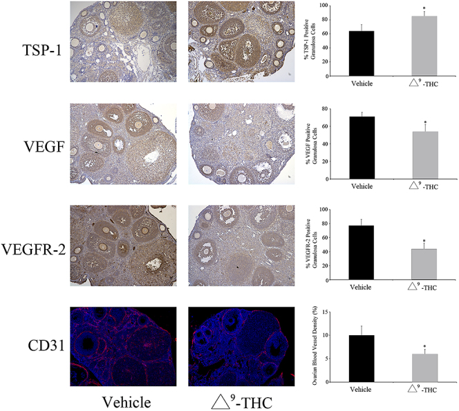 Expression of thrombospondin 1 (TSP-1), VEGF, vascular endothelial growth factor receptor 2 (VEGFR-2) and CD31 in vehicle (n = 5) and prenatally Δ9-THC-exposed (n = 6) rat ovaries. Mean ± SEM. Student’s t-test; *P < 0.05. Adapted with permission from Martínez-Peña AA, Lee K, Petrik JJ, et al. 2021 Gestational exposure to Δ9-THC impacts ovarian follicular dynamics and angiogenesis in adulthood in Wistar rats. J Dev Origins Health Dis 12 865–869.
