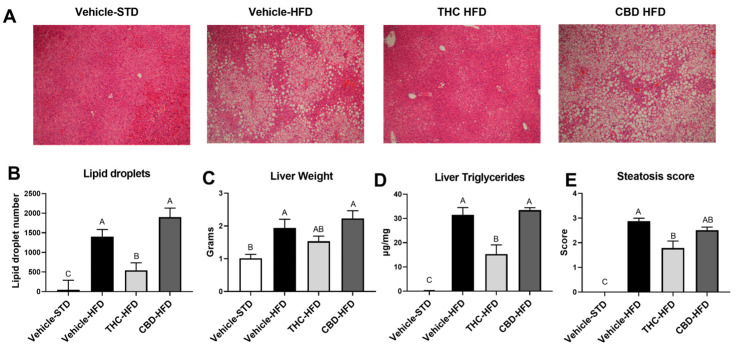 Effect of THC and CBD on obesity-induced steatosis. Obesity-induced steatosis was assessed at the end of the treatment regime in mice treated with CBD or THC: (A) representative liver tissue sections stained with H&E (magnification × 100); (B) morphological analysis of liver droplet density (n = 5); (C) weights of liver; (D) levels of hepatic triglycerides (n = 3); (E) the severity of steatosis was blindly scored as described by Liang et al. [21] (n = 3). Data are shown as mean ± SEM. Statistical significance was determined via one-way ANOVA followed by Tukey’s post hoc test. Different subscribed letters indicate significant differences between groups, p < 0.05.