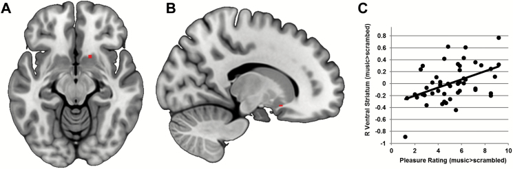 Correlation between brain and behavior. (A) Axial slice of right ventral striatal region of interest, identified from voxelwise analysis. (B) Sagittal slice of the same region. (C) Across all scans, activation in right ventral striatum for the contrast music>scrambled correlated positively with pleasure ratings.