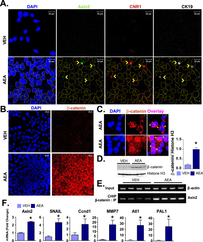 AEA-induced co-expression of Axin2, CB1R, and CK19 (Krt19) mRNA, as well as that for β-catenin and its target genes, in mouse HPCs.A RNAscope analyses of the effect of AEA (300 nM) on the expression of Axin2, Cnr1, and CK19 and in BMOL. Yellow arrows in panel A illustrate co-expression of the three mRNAs in the same cell. Co-expression is also illustrated by an overlay. B, C Effect of AEA (300 nM) on β-catenin protein localization in the nuclear membrane/nucleus in BMOL cells, as visualized by confocal immuno-histochemistry, including two sets of overlaid images at higher magnifications for AEA group. D Immunoblot analyses of β-catenin from nuclear fraction obtained four independent experiments and their quantifications. Histone H3 was used as a nuclear fraction validation marker. E CHIP analyses of Axin-2 promoter pulled by β-catenin antibody. Input DNA control was validated by β-actin. F Real-time PCR analysis of AEA induction of β-catenin target genes Axin2, Mmp7, Snail, Ccnd1, Atl1, and PAI1 (n = 3/groups, *P < 0.05 compared to vehicle-treated cells.