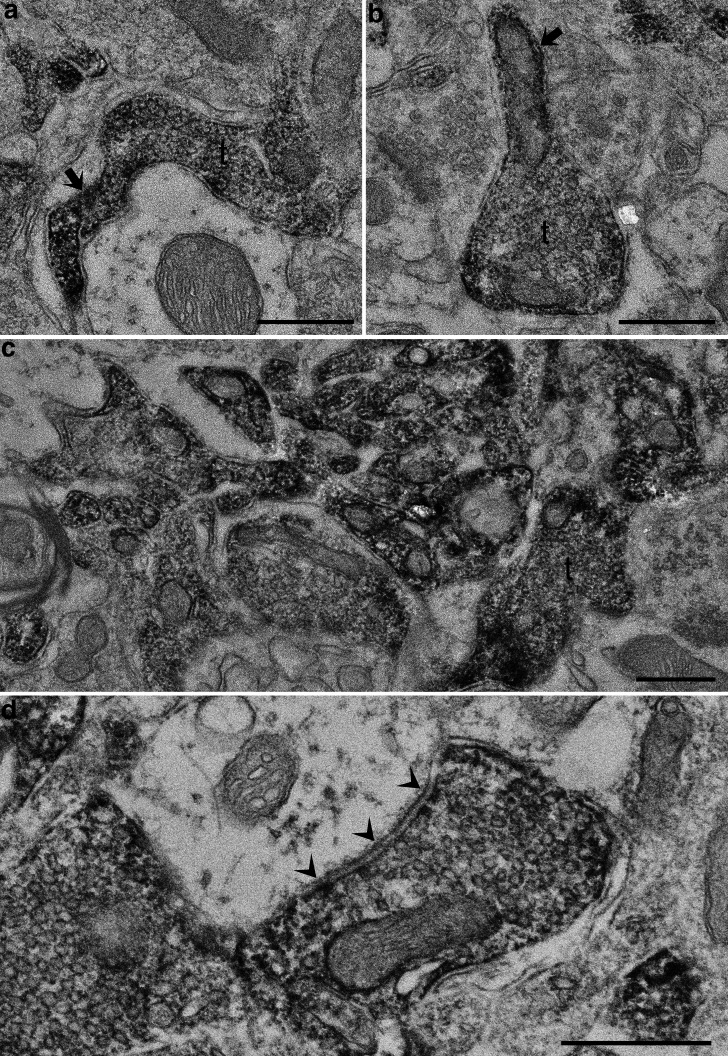 a–d, Electron micrographs illustrating the immunohistochemical localization of CB1R in the EPN. CB1R-immunoreactive elements labeled by DAB are located in preterminal axons (a, b, arrows) and axon terminals (t). The accumulation of labeled axons and axon terminals shown in c is consistent with diffuse, intense labeling observed in CLSM. Arrowheads in d indicate a symmetrical synapse. Scale bars, 0.5 μm.