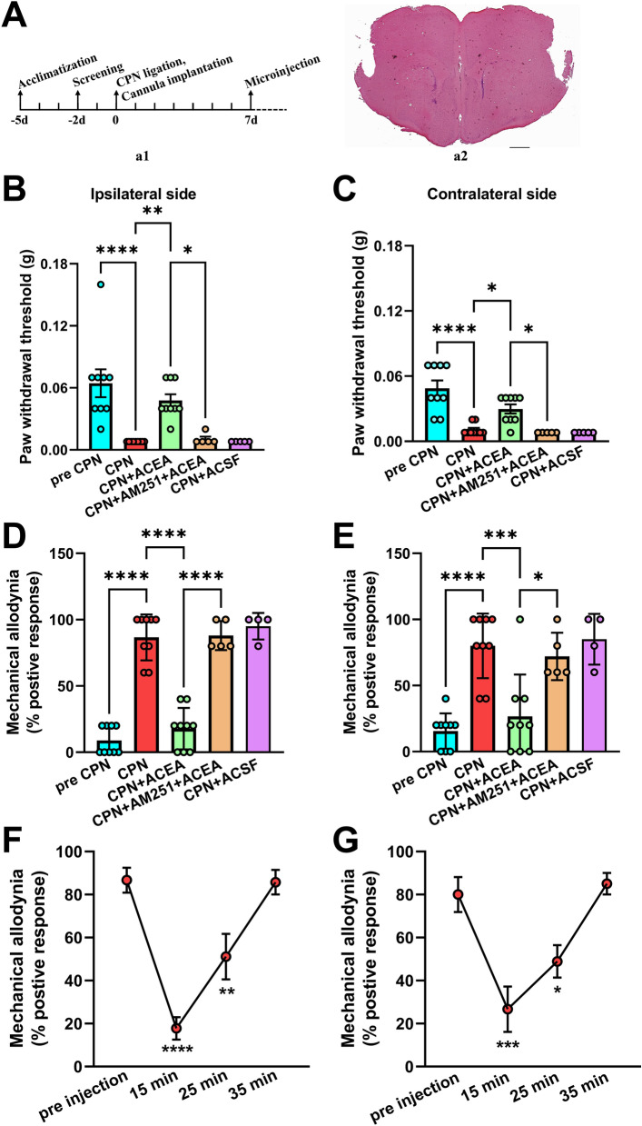 Inhibition of mechanical allodynia and hyperalgesia via CB1R activation in the RAIC following CPN ligation. A (a1) time course of behavioral experiments including the acclimatization, screening, CPN ligation, cannula implantation, and microinjection; (a2) a hematoxylin/eosin-stained section showing the cannula locations for microinjection (scale bar, 200 μm). B, C Bilateral PWTs increase significantly after ACEA (2 μmol/L, 0.5 μL) is microinjected into the RAIC (CPN 6 days vs ACEA, 9 mice). AM251 (2 μmol/L, 0.5 μL, 5 mice), a CB1R antagonist, is microinjected before ACEA (10 min). The analgesic effect of CB1R activation on the PWTs on both sides is blocked by AM251 (AM251+ACEA vs ACEA). D, E Mechanical allodynia of both sides is significantly inhibited by ACEA (CPN 6 days vs ACEA). And the analgesic effect of ACEA on allodynia is also inhibited by AM251 (AM251+ACEA vs ACEA). F, G The duration of the ACEA-mediated analgesic effect on mechanical allodynia (9 mice). (B–E) The control solvent ACSF is also microinjected into the bilateral RAIC. Pain behaviors in the sham and CPN groups are not influenced by the ACSF. *P <0.05, **P <0.01, ***P <0.001, ****P <0.0001, one-way ANOVA.