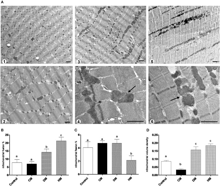 Mitochondrial morphology and dynamics. The photomicrographs are the transmission electron microscopic images of the soleus muscles taken from the control (A1), CM (A2), DM (A3,4), and HM-treated animals (A5,6). Mitochondrial fusion was observed more frequently in the samples of DM (A3,4) and HM animals (A5,6). Arrows indicate the fusion points. Scale bars, 1 μm. Mitochondrial fusion and fission are quantified as percentage of mitochondria undergoing fusion (B) and fission (C) in reference to the total number of the mitochondria in the visual field. (D) Mitochondrial volume density. Data are presented as means ± SEM from n = 7 animals/group. Labeled means without a common letter differ (P < 0.05).