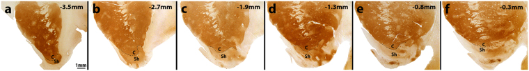 Photomicrographs of calbindin-stained coronal sections of basal forebrain across the rostrocaudal axis. (a–f) The first rostral section of the NAc was taken at approximately 3.5 mm anterior to the anterior commissure (AC) and the last caudal section was taken 0.3 mm anterior to the AC. The total length of the NAc was approximately 4 mm. Each slice distance relative to the AC is designated in the top right corner. The calbindin stain indicates the core and shell border of the NAc by overlaid dashed lines. The demarcation of core and shell is based on our own observation and previously published work39,40. Scale bar = 1 mm. C = core; Sh = shell.