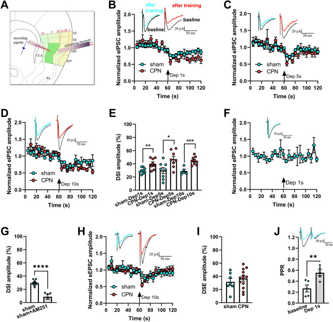 Increased DSI magnitude in layer V pyramidal neurons in the RAIC following CPN ligation. A Schematic of layer V neurons in the RAIC. In the electrophysiological study, the stimulating electrode was fixed in layers II–III. Pyramidal neurons in the RAIC layer V were recorded (green patch). AID, agranular insular cortex, dorsal part; AIV, agranular insular cortex, ventral part; CLA, claustrum; DI, dysgranular insular cortex; GI, granular insular cortex. B–D Protocol for different durations of depolarization (from –60 mV to 0) in layer V pyramidal neurons. Upper panels: representative currents under the given protocol. The baseline trace is the average before training (black). The post-training trace is the average of the next three sweeps after the protocol (cyan or red). The depolarization duration was 1 s (B, sham n = 14, 5 mice; CPN n = 7, 4 mice), 5 s (C, sham n = 8, 3 mice; CPN n = 8, 5 mice), 10 s (D, sham n = 7, 4 mice; CPN n = 8, 4 mice). The evoked IPSC amplitude decreases significantly after training. E DSI amplitude, the inhibitory rate of IPSCs was calculated at different durations. F Representative eIPSC currents recorded in RAIC pyramidal neurons of sham mice (black trace: baseline; cyan trace: after training). AM251 (2 μmol/L) is perfused in the recording fluid for 20 min before DSI recording. The inhibitory effect of the depolarization protocol on evoked IPSC amplitude disappeared (n = 5, 3 mice). G DSI is blocked by AM251. H Evoked EPSC amplitude is decreased when the depolarized protocol is applied (sham n = 7, 4 mice; CPN n = 15, 3 mice). Representative traces of eEPSCs from the sham and CPN ligation mice are shown above. I There is no significant difference in DSE amplitude in the two groups. J Representative traces with an interval of 50 ms recorded in layer V of the RAIC (black trace: baseline; green trace: depolarization for 1 s). The depolarization protocol (duration 1 s) amplified the PPR (n = 4, 3 mice). *P <0.05, **P <0.01, ***P <0.001, ****P <0.0001, compared to the sham group or baseline values; unpaired t-test.