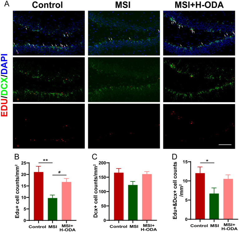 Effects of neonatal ODA supplementation on hippocampal neurogenesis of MSI-exposed offspring rats. (A) Representative immunofluorescence images displaying the staining of DCX (green) and EdU (red), with merged images showing EdU-labeled cells indicated by white arrows in the DG region of the hippocampus from different groups. Scale bar: 100 μm. Quantification of the cell density: (B) EdU+, (C) DCX+, and (D) EdU+ &DCX+ cells in the hippocampal DG region for each group. Data are presented as mean ± SEM; n = 6 per group. *p < 0.05 and **p < 0.01 versus the control group; #p < 0.05 versus the MSI group. DAPI, 4,6-diamidino-2-phenylindole; DG, dentate gyrus; DCX, doublecortin; EdU, 5-ethynyl-2′-deoxyuridine; MSI, maternal sleep interruption; H-ODA, 25 mg/(kg · day) oleamide.