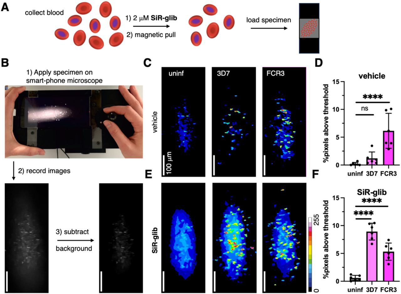 Imaging and analysis of P. falciparum infected RBCs using a portable smartphone-based microscope.A) Sample preparation for smart-phone based imaging. B) Workflow showing the mounted smartphone, image recording and background subtraction (photo reproduced from ref. [10]). C) Vehicle controls of uninfected and 3D7- or FCR3-infected RBCs. D) Analysis of vehicle-treated RBCs show a significant increase in pixels above threshold for FCR3-infected RBCs. E) As for (C) but SiR-glib-treated RBCs. F) Analysis of SiR-glib-treated RBCs show a significant increase in pixels above threshold for RBCs infected with both strains, also enabling the detection of the 3D7 strain.