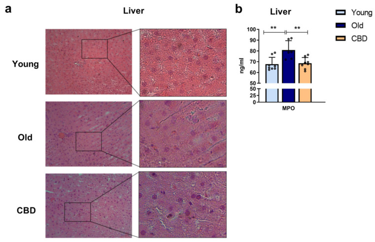 (a): Histology of liver sections. Representative images of livers from young, old and CBD-treated animals stained with H&E. Images indicate 200 µm (20×) and the magnified image of the characteristic tissue section (40×). (b): Concentration of MPO in ng/mL in liver samples. Data represent mean ± SD. Individual data points are also shown. Light blue bar represents young group, dark blue bar represents old group and yellow bar represents the group of old animals treated with CBD. n = 8 rats per experimental group. ** p < 0.01.