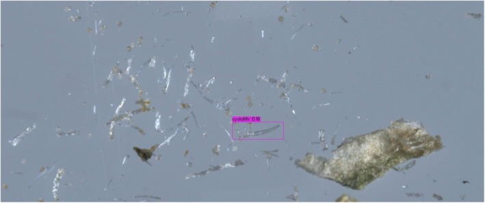 Correct YOLO detection of a cystolith from genuine cannabis material. YOLO outputs bounding boxes surrounding detected objects, each with a class label and a confidence value.