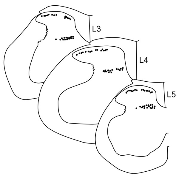 Location of recorded SDH and DDH neurons in lumbosacral spinal cord. The location of each recorded neuron was plotted on templates of the L3, L4, and L5 spinal cord segments. Approximately 30 neurons were recorded in each segment. For SDH neurons, recordings were obtained across the entire medio-lateral extent of the dorsal horn. For DDH neurons, recordings were concentrated in the medial two thirds of the dorsal horn because dense myelination impedes visualizing neurons in lateral DDH.