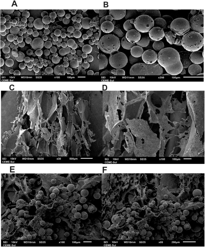 SEM images of PLGA@CBD microparticles alone (A, B), control hydrogel (C, D), PLGA@CBD10.0% hydrogel (E), and PLGA@CBD5.0% hydrogel (F)
