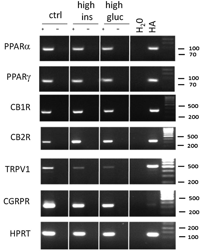 The effects of high insulin and glucose on the expression of cannabinoid targets in HAECs. RT-PCR showing the presence of PPARα and γ, CB1, CB2, TRPV1, CGRP receptors, and a house-keeping gene hypoxanthine-guanine phosphoribosyltransferase (HPRT) in human aortic endothelial cells (HAECs) grown in control conditions (first column) or a high insulin (500 nM, second column) or high glucose (25 mM, third column) environment for 96 h. Human astrocytes (HA) are shown as a positive control for cannabinoid targets.