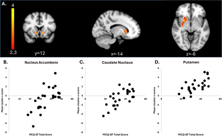 Correlations with ventral tegmental area‐striatal connectivity (preCue + postCue) and craving in the CU group. (A) Significant clusters of activation were observed in the nucleus accumbens (left), the head of the caudate (middle) and the right putamen (right). (B) Scatter plots reflect the mean z‐score within the significant cluster for each individual and are included for illustrative purposes only. Images are presented in radiological convention (R = L).