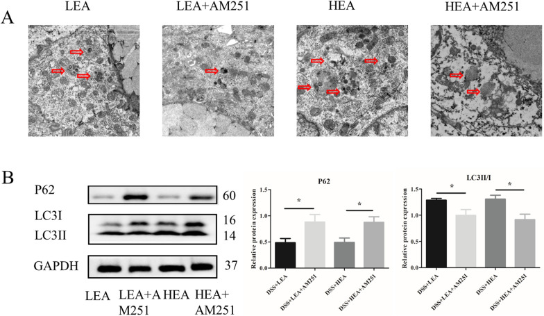 AM251 reversed the effects of EA on autophagy. A The autophagosome in the colon. B The protein levels of autophagy-related proteins in the colon (n = 6 mice per group, *P < 0.05 vs. the EA group)