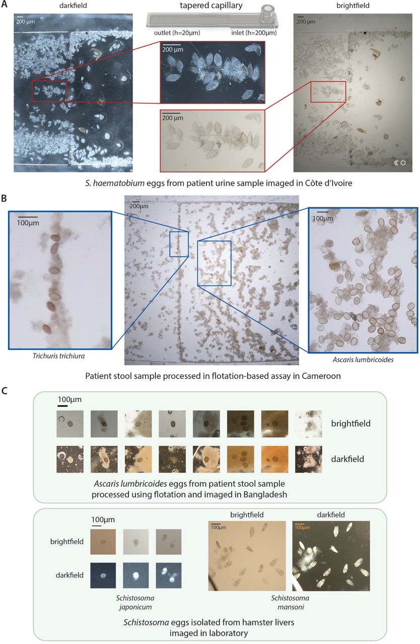 NTDscope can image parasitic eggs in urine and stoolA Images of Schistosoma haematobium eggs from a urine sample of a patient in Côte d’Ivoire, acquired using brightfield (BF) and darkfield (DF) imaging. B Image of soil-transmitted helminth (STH) eggs from a patient stool sample processed using a flotation-based assay and imaged using the NTDscope in Cameroon. Insets showing Trichuris trichiura (left) and Ascaris lumbricoides (right) eggs captured in different locations of the NTDscope tapered capillary. C (top) images of A. lumbricoides eggs from a patient stool sample, processed with a flotation solution and imaged using BF and DF illumination on the NTDscope in Bangladesh. (bottom) Schistosoma japonicum and Schistosoma mansoni eggs isolated from hamster livers and imaged on the NTDscope using BF and DF illumination.