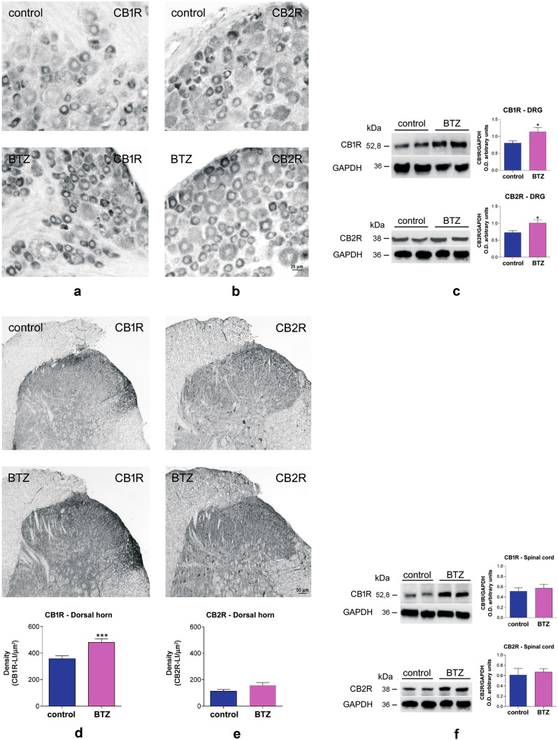 Effects of bortezomib (BTZ) treatment on CB1R and CBR2 expression in DRG and SCDH Localization of CB1R-like immunoreactivity (LI) in the DRG of a control (a, upper panel) and a BTZ-treated rat (a, lower panel); localization of CB2R-LI in the DRG of a control (b, upper panel) and a BTZ-treated rat (b, lower panel); western blot and results quantification comparing control vs BTZ-treated animals (c). Localization of CB1R-L5 in the SCDH of a control (d, upper panel) and a BTZ-treated rat (d, intermediate panel) with optical density quantification (d, lower panel); localization of CB2R-LI in the SCDH of a control (e, upper panel) and a BTZ-treated rat (e, intermediate panel), with optical density quantification (e, lower panel); western blot and results quantification of the whole spinal cord comparing control vs BTZ-treated animals (f). *P<0.05 vs control; ***P<0.001 vs control. For more details about Materials and Methods, see Supplementary material