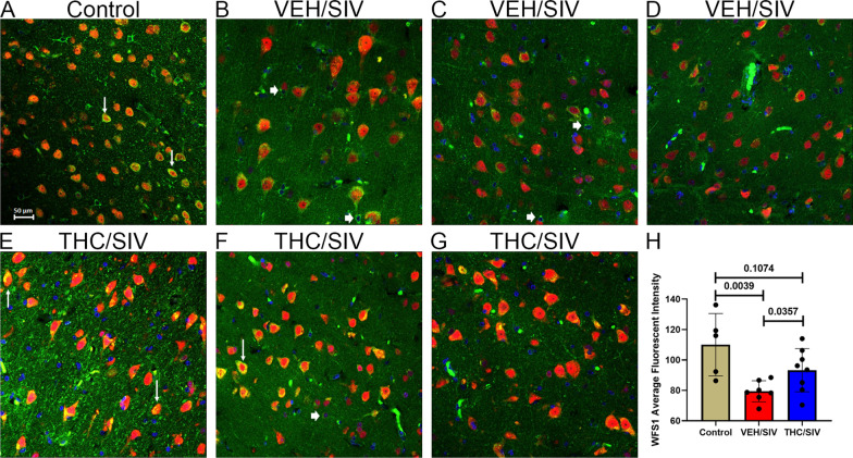 Chronic THC administration increased WFS1 protein expression in the basal ganglia of chronically SIV-infected RMs. Basal ganglia tissues of uninfected control (A), VEH/SIV (B–D), and THC/SIV RMs (E–G) were immunostained for WFS1 (green), NeuN (red), and DAPI for nuclear staining (blue). Note the significantly decreased WFS1 (B–D) staining in the BG of VEH/SIV RMs. In contrast, WFS1 (E–G) staining is intense in NeuN+ neurons in the BG of THC/SIV RMs. Representative immunofluorescence images were captured using a Zeiss confocal microscope at 20X magnification. Yellow staining (A, E, F) indicates colocalization of WFS1 to NeuN+ neurons (white arrow). A few NeuN− cells expressing WFS1 protein were also detected (B, C, and F, white arrowhead). Quantitation of WFS1 (H) signal intensity was performed using Halo software. Differences in WFS1 signal intensity between groups were analyzed using unpaired “t” tests after confirming data assumptions (normal distribution) employing the Prism v9 software (GraphPad software). A p-value of < 0.05 was considered significant