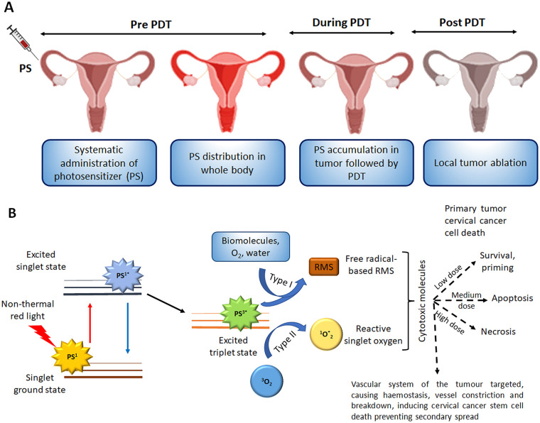 Photochemical and photobiological overview of CC PDT. (A) Clinical process of PDT and (B) Schematic representation of the Jablonski diagram showing PDT mechanism of action for tumor destruction.