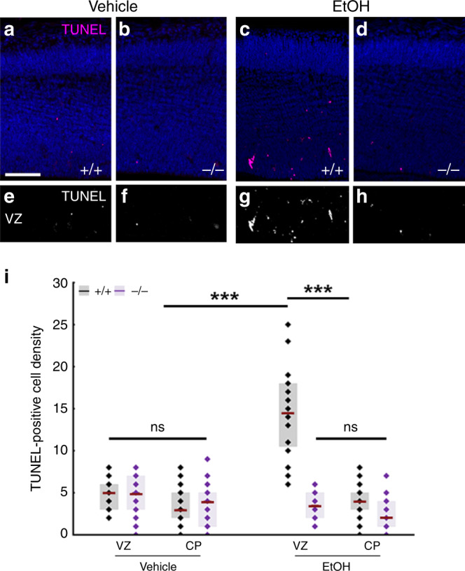ABHD4 is necessary for cell death caused by fetal alcohol exposure.Compared to vehicle-treated mice (a, b, e, f), increased number of TUNEL-positive dead cells is seen in ethanol-treated wild-type (+/+), (c, g), but not in Abhd4-knockout (−/−) mice (d, h) in the ventricular (VZ) zones of embryos derived from dams undergoing subchronic alcohol treatment, but not in the cortical plate (CP). i Quantification of the density of TUNEL-positive cells in the VZ and in the CP after subchronic ethanol-treatment (Kruskal–Wallis test with post hoc Dunn’s test, ***P < 0.0001; ns = not significant, P ≈ 1, n = 31 sections from n = 5 animals per wild-type, vehicle-treated mice, n = 27 sections from n = 4 animals per Abhd4-knockout, vehicle-treated mice, n = 24 sections from n = 4 animals per wild-type, ethanol-treated mice, n = 18 sections from n = 3 animals per Abhd4-knockout, ethanol-treated mice). Graphs show box-and-whisker plots (including minima, maxima, and median values, lower and upper quartiles) with single values. Scale bars: a–h: 100 μm. Source data are provided as a Source Data file.