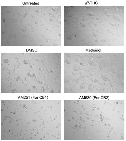 Effects of Δ9-THC and cannabinoid inhibitors (AM251 and AM630) on Rosa ES cell survival.Rosa ES cells were either untreated (as control) or treated with Δ9-THC, control DMSO (0.01%), control methanol (0.01%), or with the inhibitors AM251 (for the CB1 receptor) or AM630 (for the CB2 receptor), as indicated. After 48 hours, the cells were analyzed for their viability by light microscopy. This is a representative experiment out of three experiments.