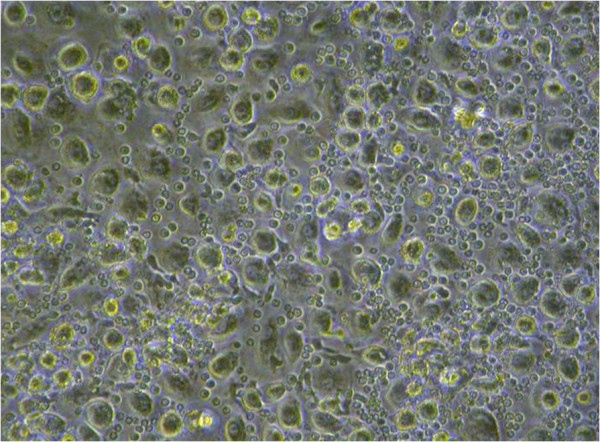 Representative optical photomicrograph of blood monocyte-derived macrophages (BMDMs) in vitro culture from autistic children.