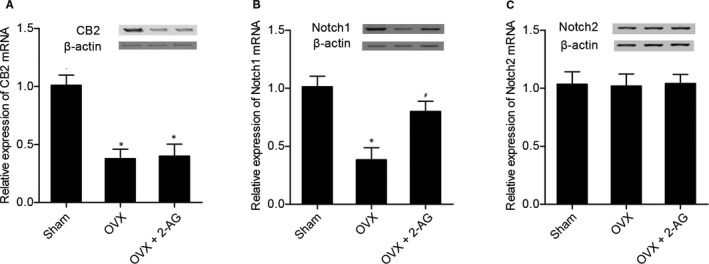 Real‐time PCR and Western blot analysis were carried out to detect the levels of CB2, Notch1 and Notch 2 among sham, OVX and OVX + 2‐AG groups (*P value <.05 vs sham group; #P value <.05 vs OVX group). (A) CB2 levels in OVX and OVX + 2‐AG groups were much lower than that in the sham group. (B) Notch 1 levels in OVX and OVX + 2‐AG groups were much lower than that in the sham group, and Notch 1 level in the OVX group was lower than that in the OVX + 2‐AG group. (C) Notch 2 level was comparable among sham, OVX and OVX + 2‐AG groups