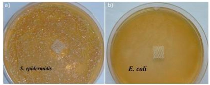 The agar diffusion tests of (a) S. epidermidis (b) E. coli.