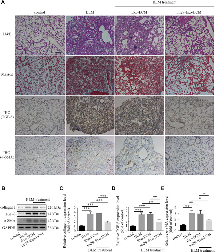 Pulmonary fibrosis therapeutic potential of mi29-Exo-ECM biomaterial. (A) H&E staining, Masson staining and IHC of lung tissues from mice treated with BLM, Exo-ECM biomaterial, mi29-Exo-ECM biomaterial. Scale bar = 1,000 μm. (B) The changes of collagen I, TGF-β and α-SMA protein levels in pulmonary fibrosis mice after treated with mi29-Exo-ECM biomaterial. Relative expression levels of collagen I (C), TGF-β (D), α-SMA (E) were quantified. “Control”: no treatment mice; “BLM”: bleomycin-induced pulmonary fibrosis mice model; “Exo-ECM”: Exo-ECM treatment; “mi29-Exo-ECM”: mi29-Exo-ECM treatment; Data are represented as mean ± SD (n = 5). ANOVA was performed; “*”: p < 0.05; “**”: p < 0.01; “***”: p < 0.001.
