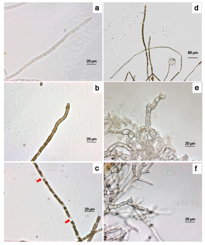 The effects of α-MG morphology of C. gloeosporioides in potato sucrose broth (PSB) for 24 h. Control hyphae (a); the hyphae treated with 500 μg·mL−1 α-MG (b–d); chemical control, 4.5 μg·mL−1 carbendazim (e) and 3.0 μg·mL−1 myclobutanil (f). Red arrows: intercellular cavity. Magnification: (a–c,e,f) 400×; (d) 200×. Bar: 20 μm.